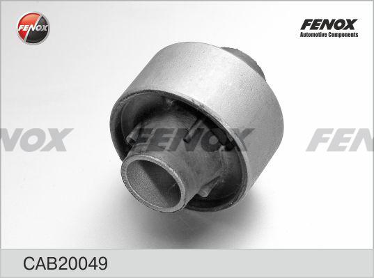 Fenox CAB20049 - Lagerung, Lenker alexcarstop-ersatzteile.com